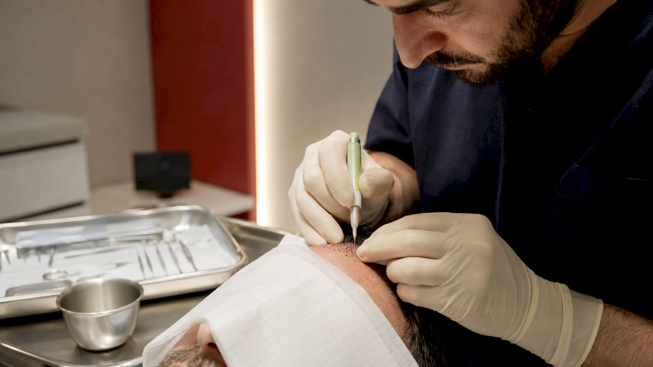 Surgeon implanting hair grafts in hairline