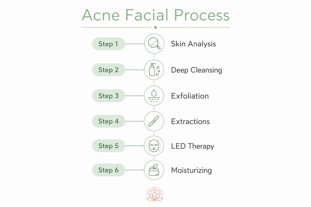 Infographic illustrating steps of acne facial treatment