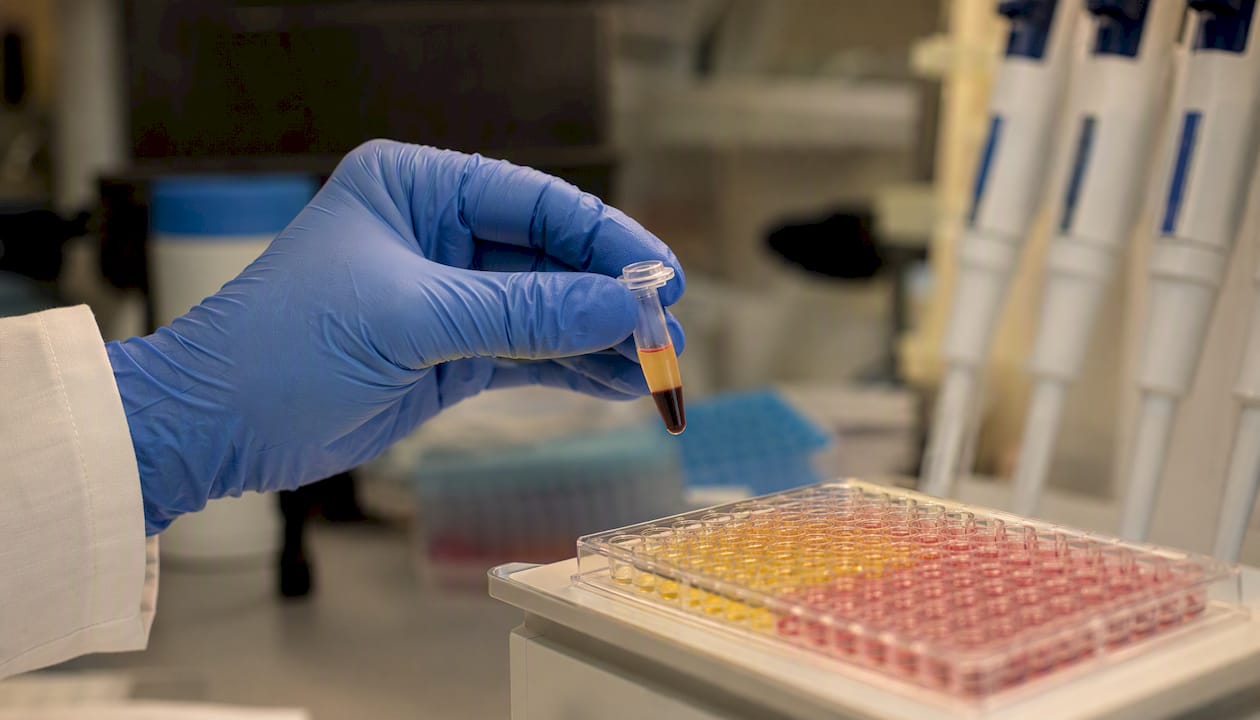 Technician holding blood plasma sample for inflammation assay