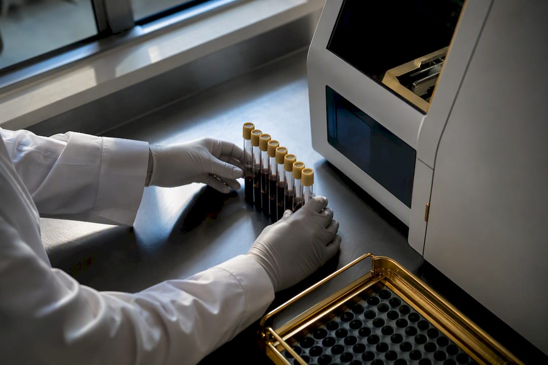 Trauma Accelerates Biological Age 0.4 Months/Year, and It Can Reverse