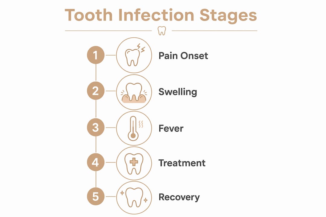 Infographic showing stages of tooth infection