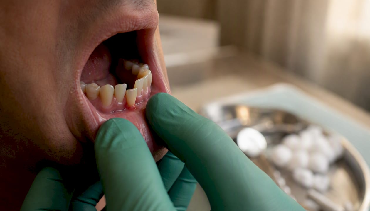 Dental professional examining loose adult tooth