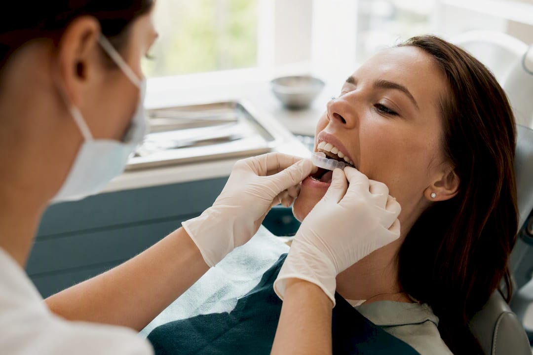 Dentist applying whitening gel tray