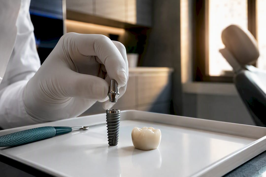 Sterile dental implant components on tray
