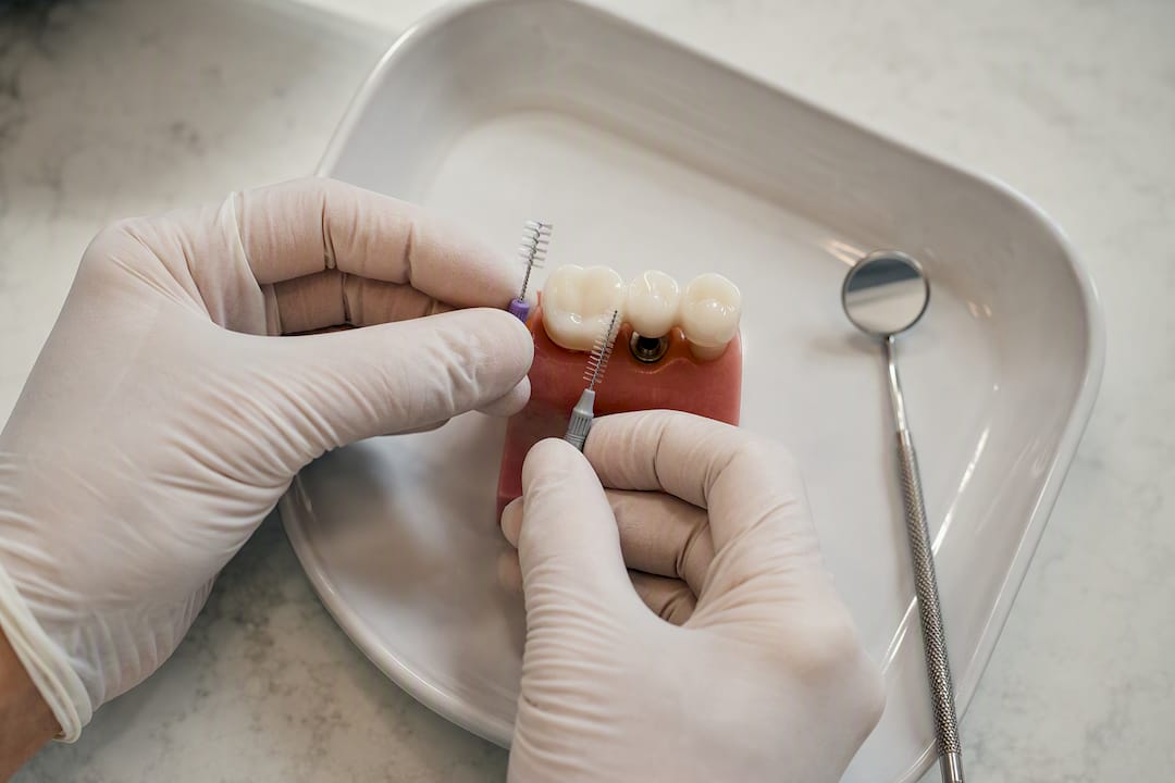 Hygienist sizing an interdental brush