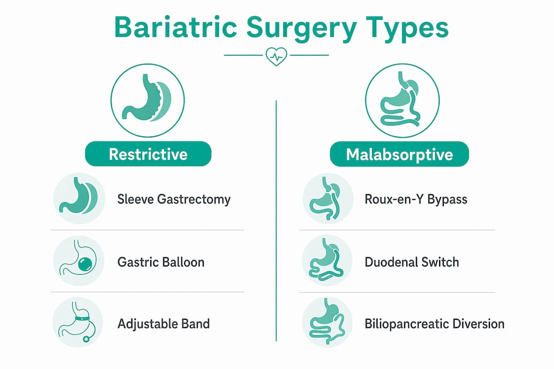 Infographic comparing bariatric surgery types restrictivemalabsorptive