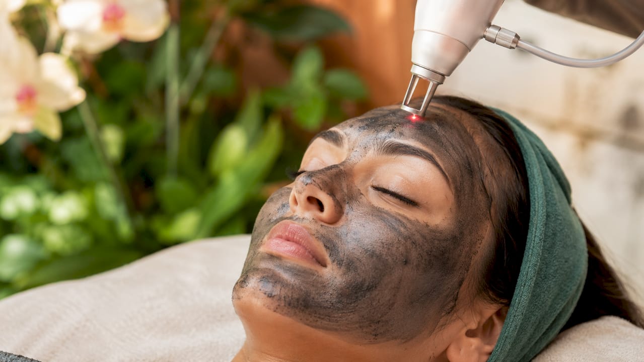 Close-up of carbon laser facial in progress