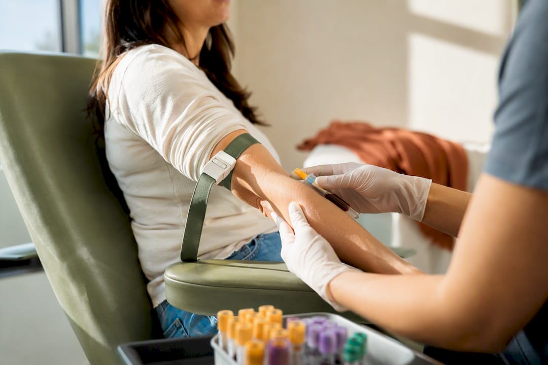 Avoid Mistimed Results: For Women, Test FSH/LH on Cycle Days 2–5