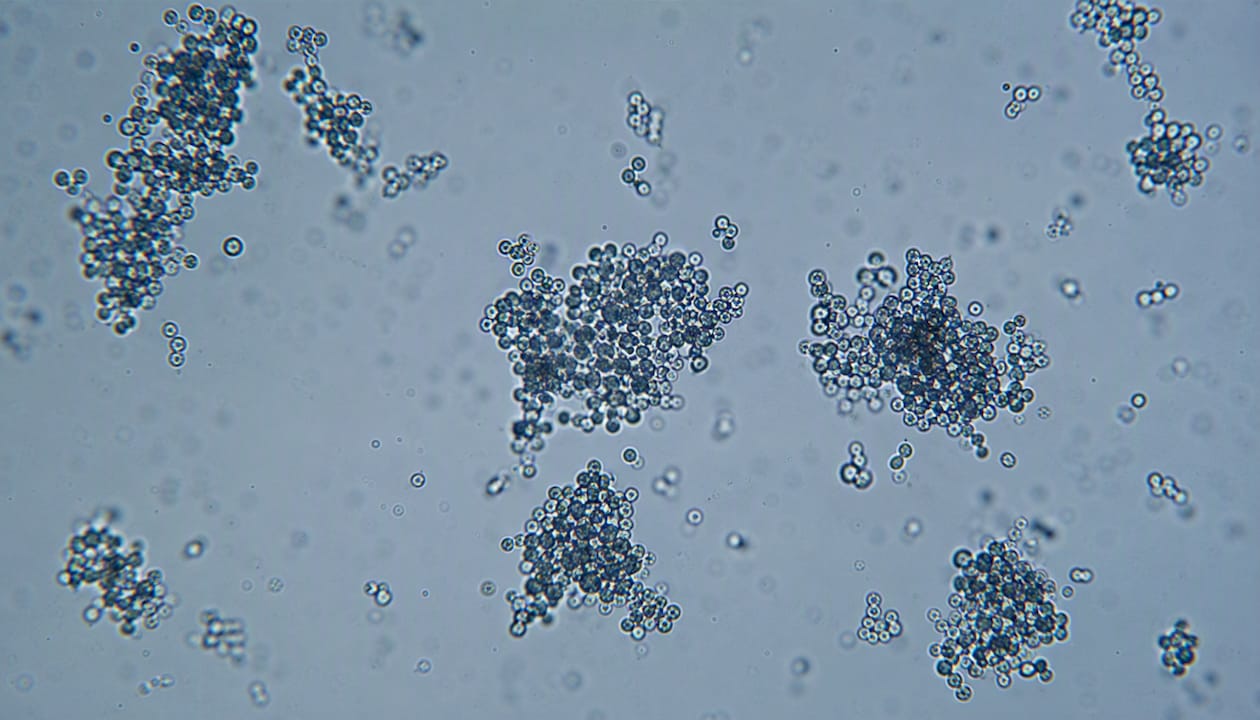 Microscope image of peptide aggregates in solution