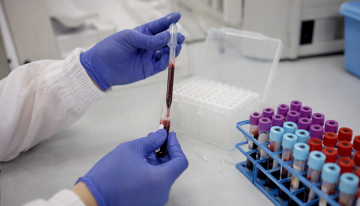 Handling fresh whole blood samples in lab