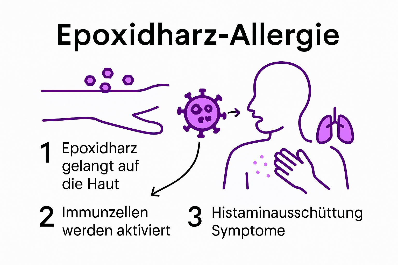 Infographic showing immunological process of epoxy resin allergy