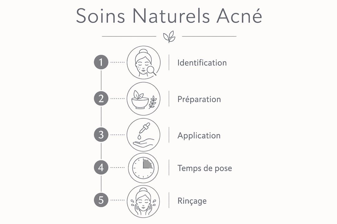 Infographie : les étapes clés pour prendre soin de sa peau acnéique au naturel