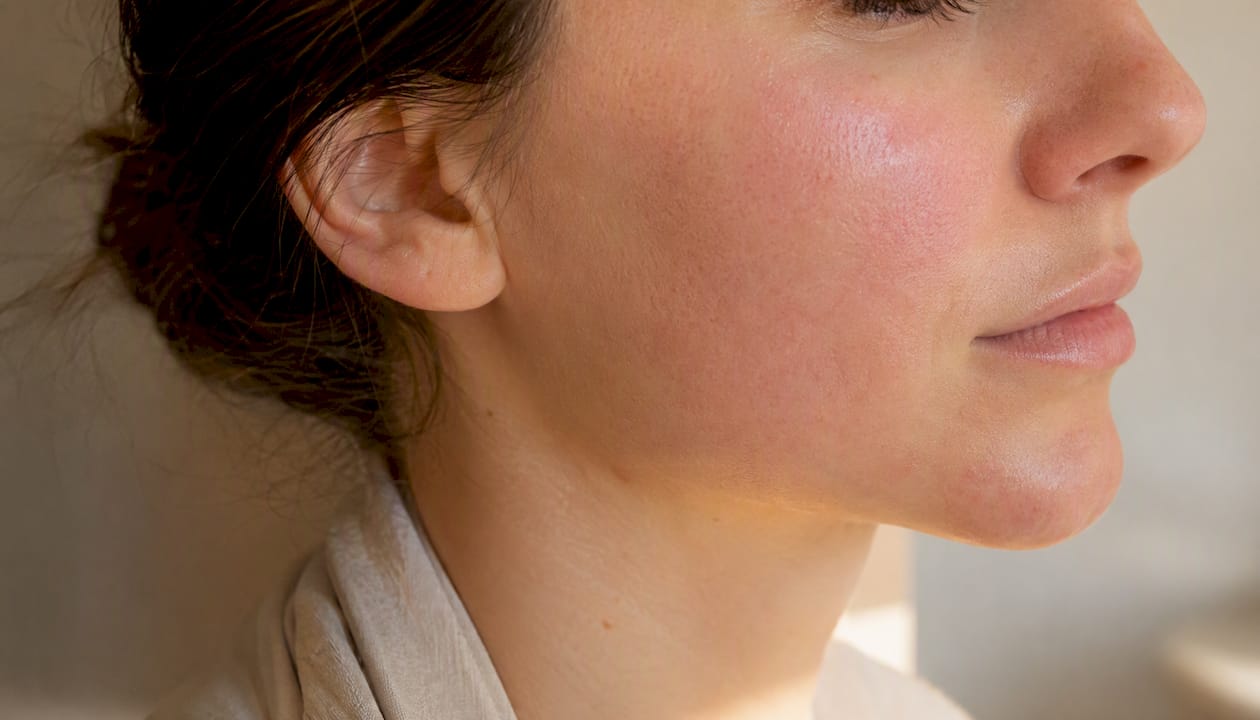 Peau du visage en gros plan présentant une légère rougeur