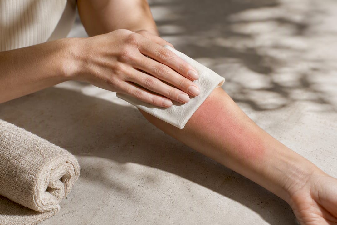 Compresa fría aplicada sobre piel irritada