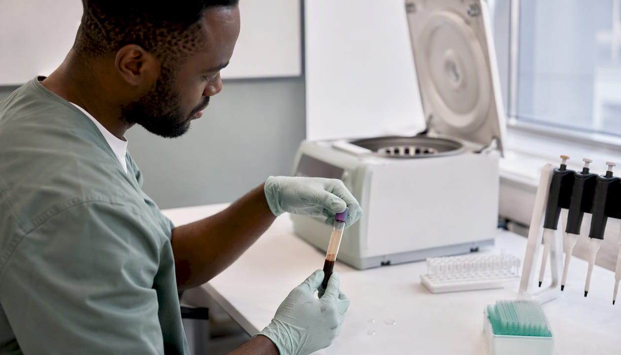 Hands isolating blood cells for T-SPOT test