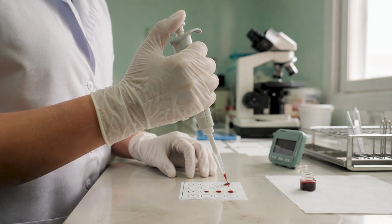 Technician performing RPR syphilis test in lab