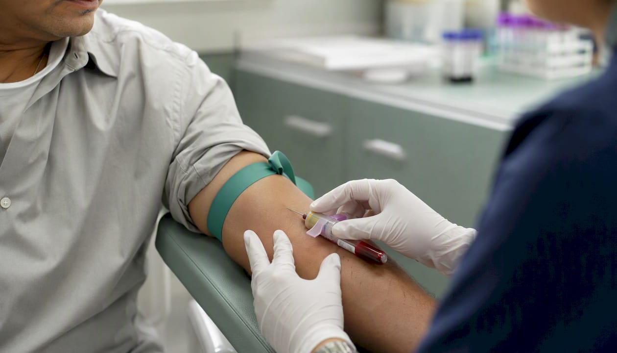 Blood draw for TB IGRA testing