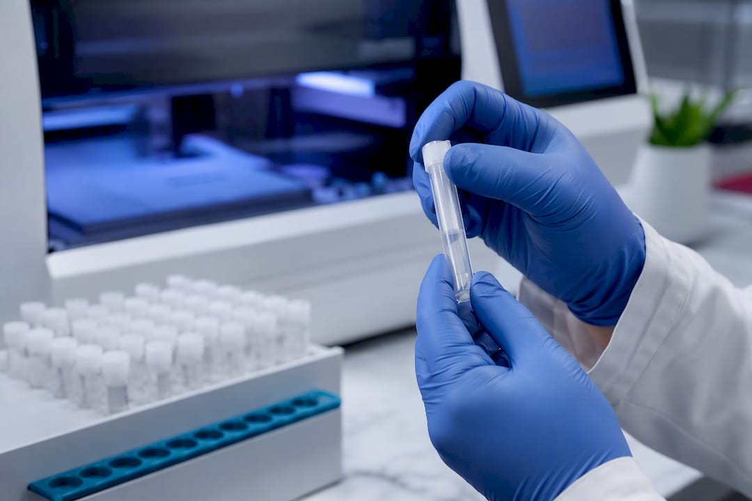 Specimen preparation for NAAT laboratory testing