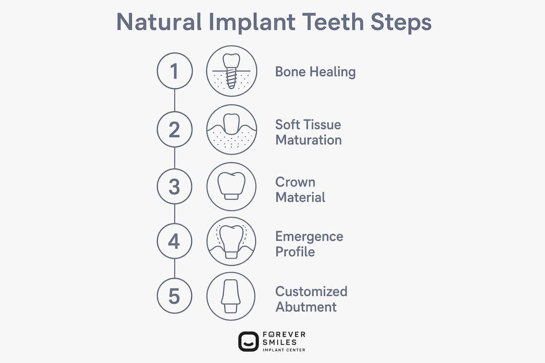 Infographic showing steps to natural implant teeth