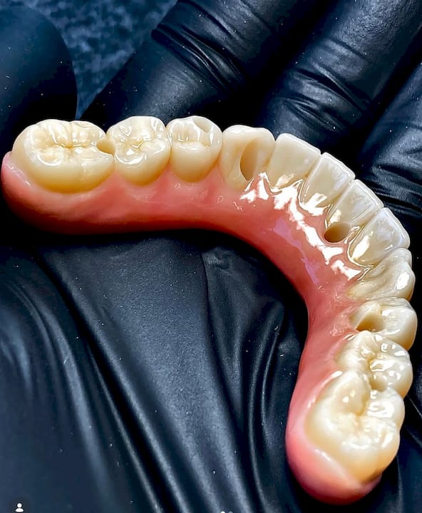 Hands holding zirconia implant crown in dental lab