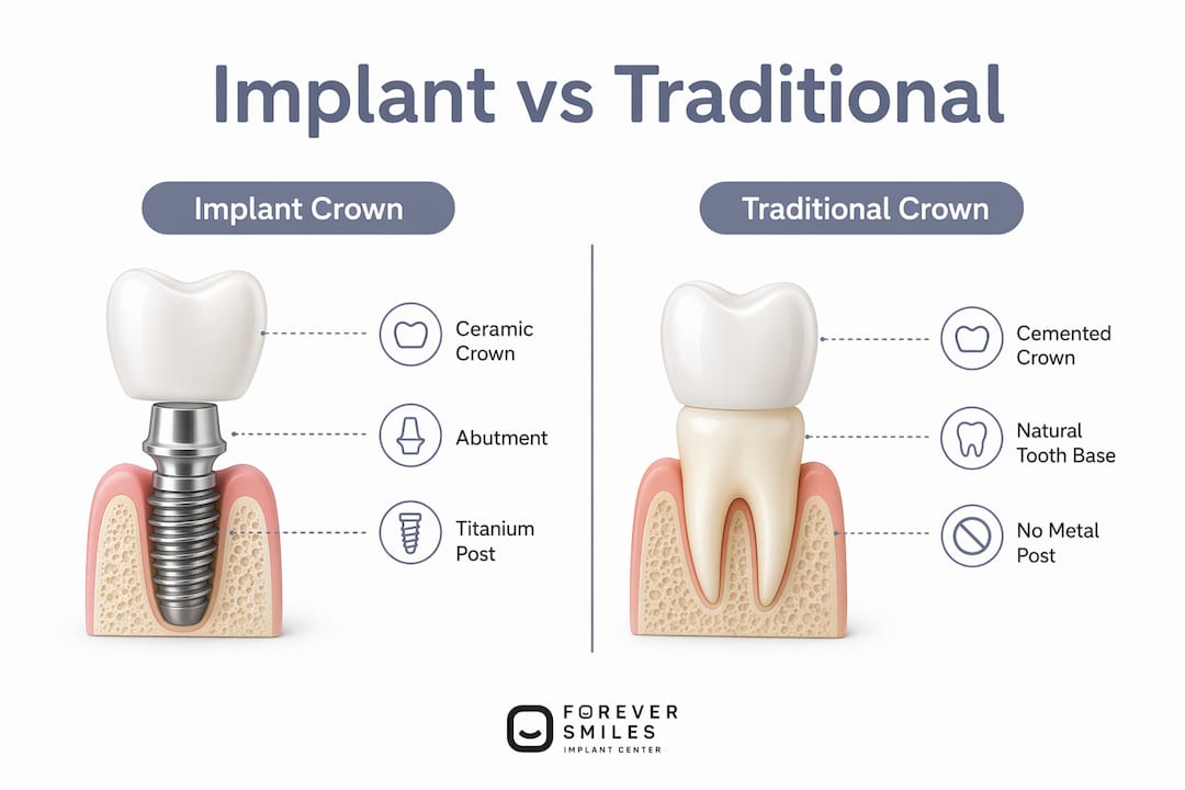 Infographic comparing implant and traditional crown systems