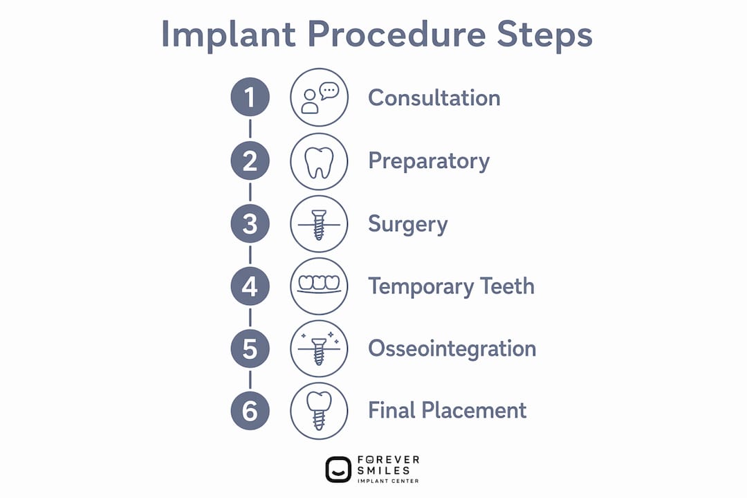 Infographic showing dental implant procedure steps