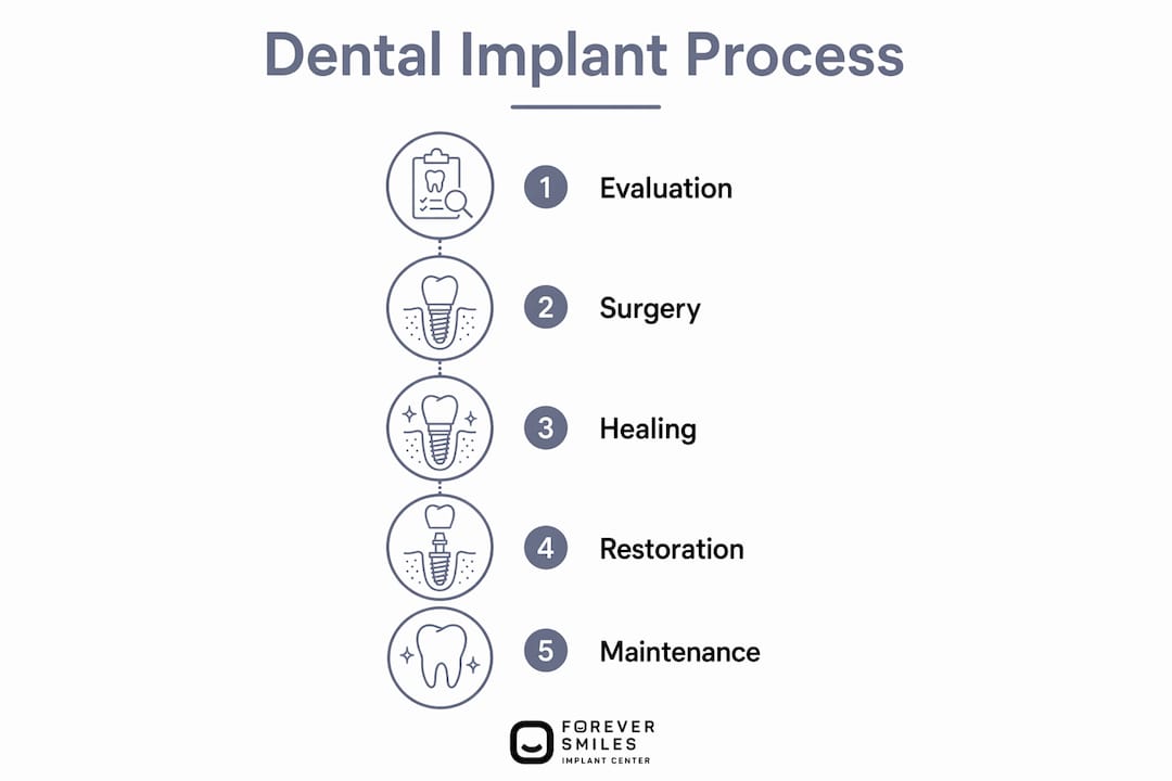 Infographic showing dental implant process steps