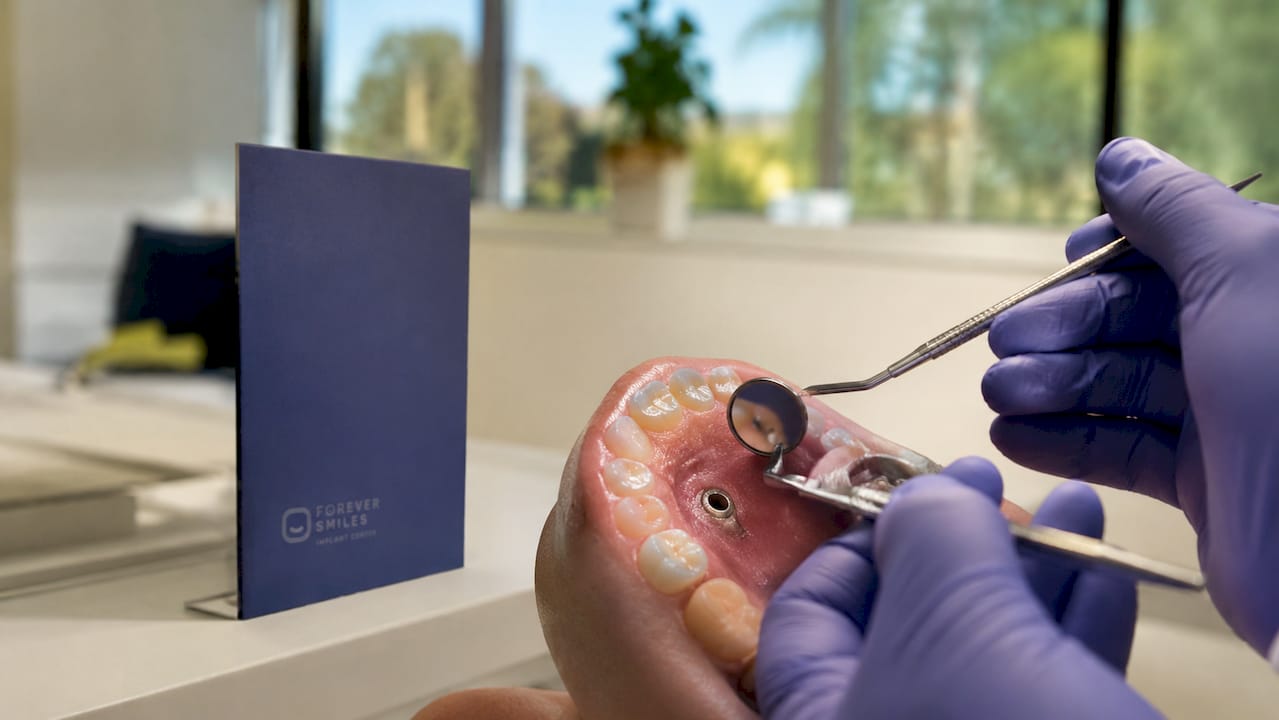 Close-up of dental implant healing in mouth