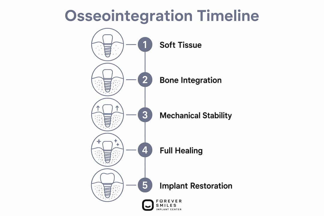 Infographic detailing osseointegration healing timeline