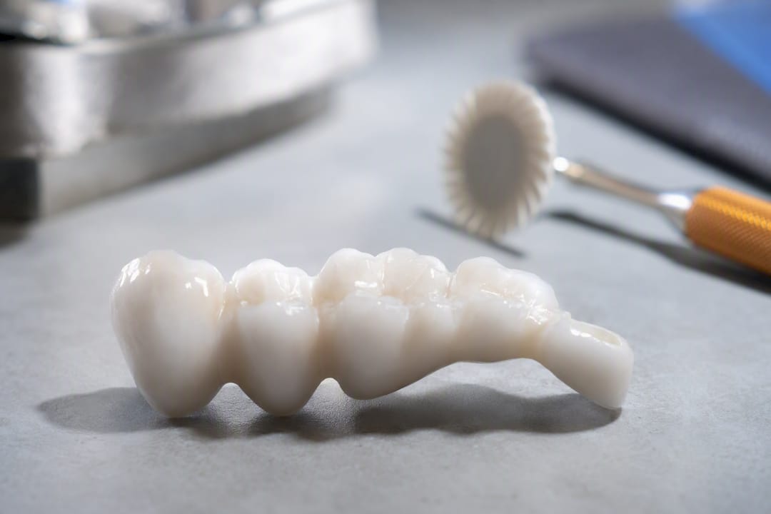 Partial monolithic zirconia bridge in laboratory