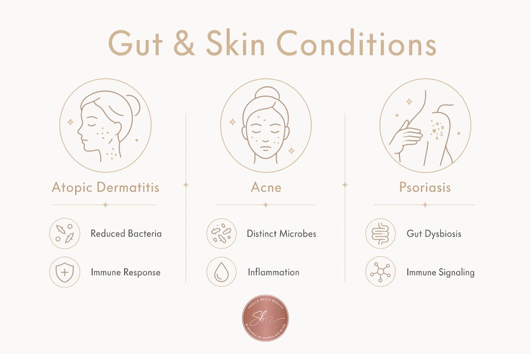 Infographic comparing gut microbiome impacts on skin conditions
