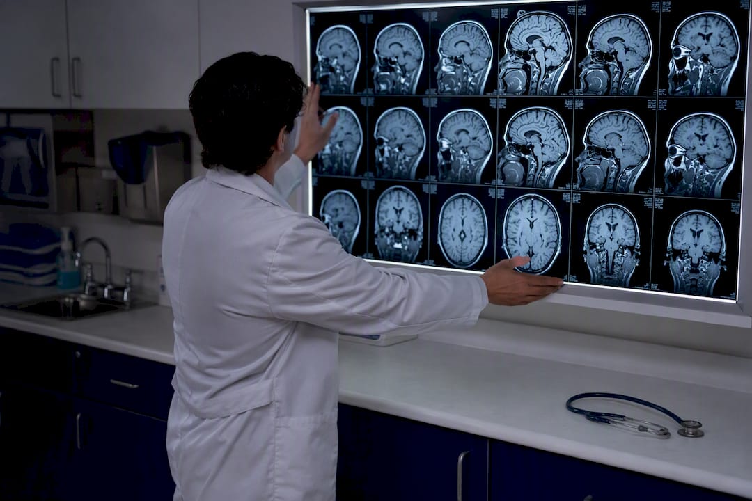Doctor adjusting MRI scans of brain injury