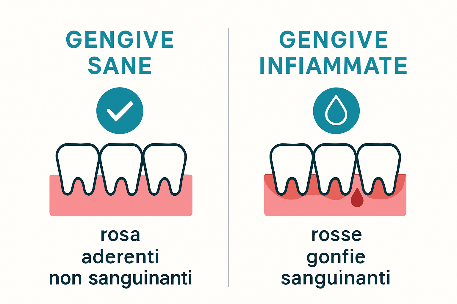 Confronto visivo tra gengive sane e gengive infiammate