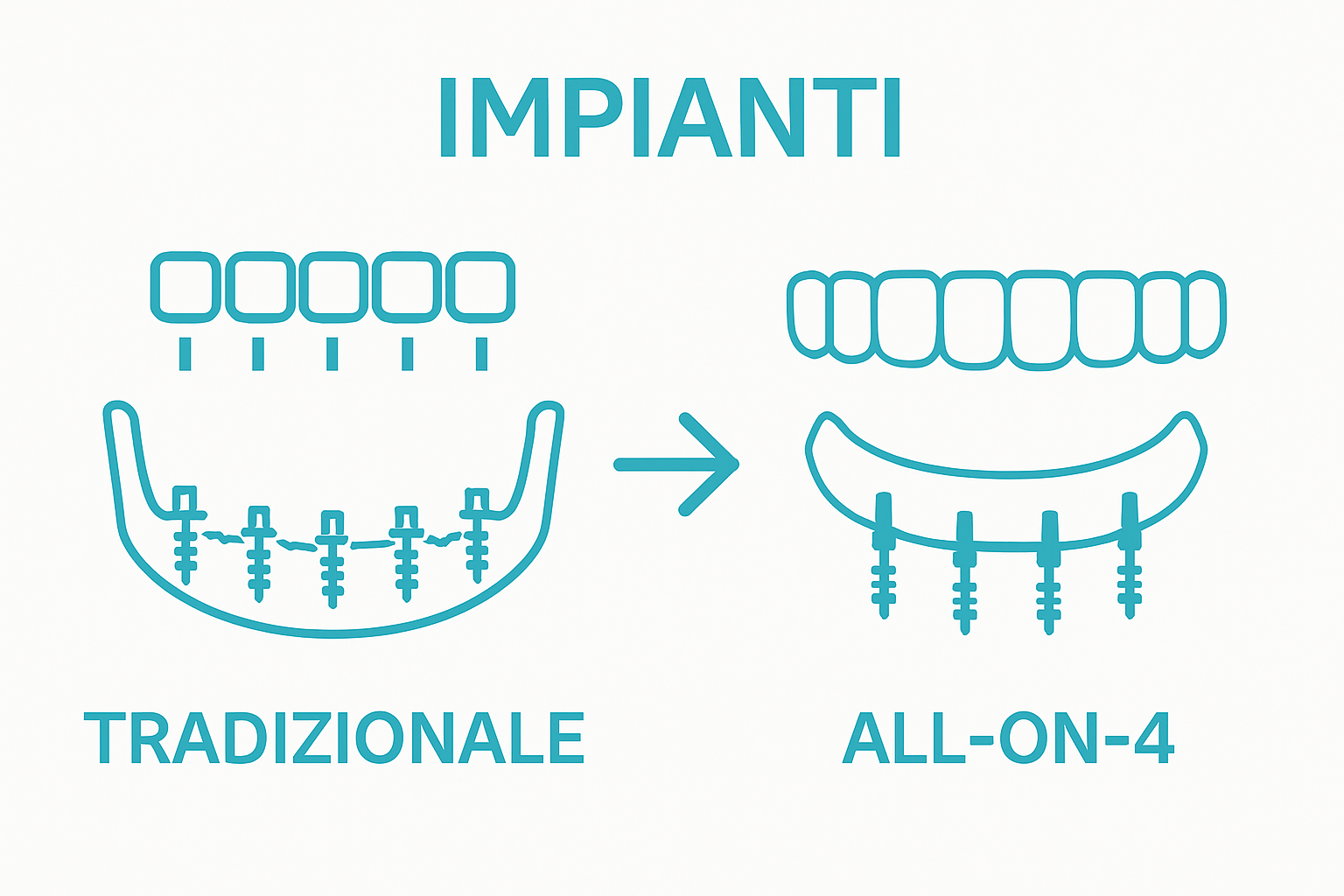 Confronto visivo tra metodo tradizionale e All-on-4
