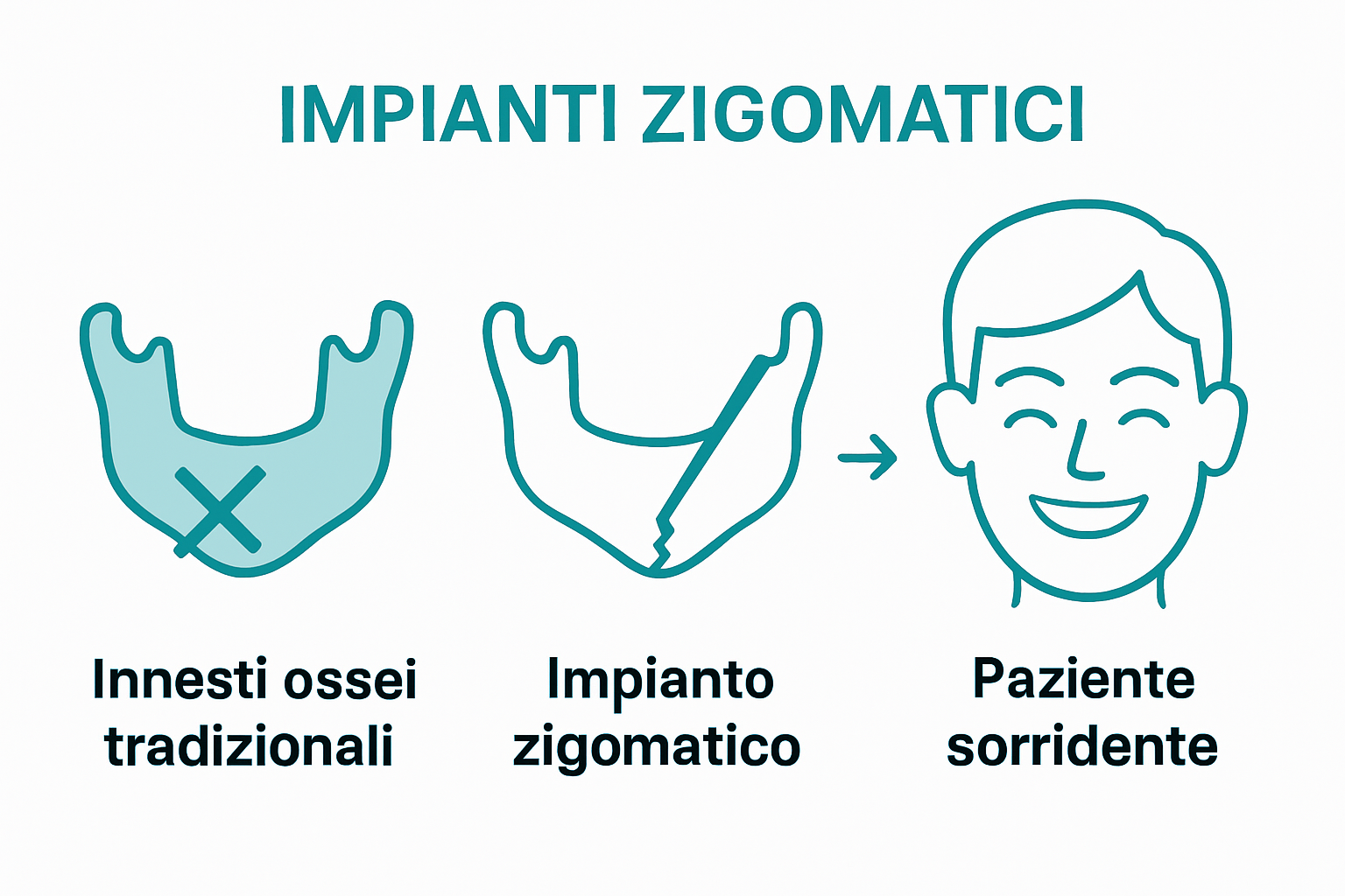 Comparison of bone graft versus zigomatic implant approaches