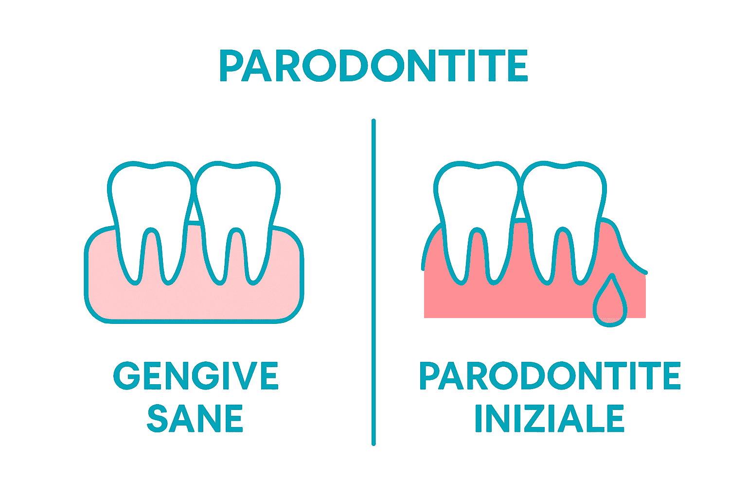 healthy gums and early parodontite symptom comparison