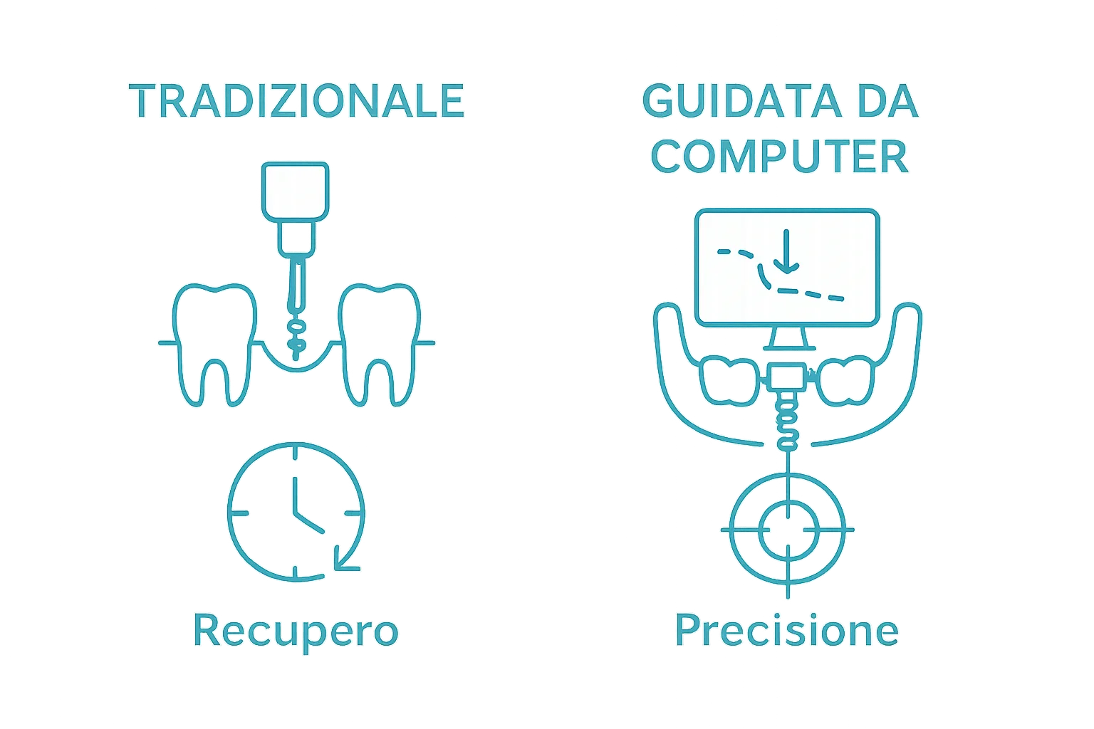 Infografica raffronta implantologia tradizionale e guidata, precisione e recupero