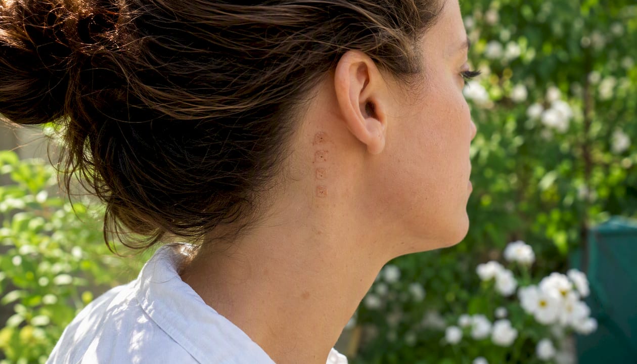 Side view of jawline and behind ear test spots