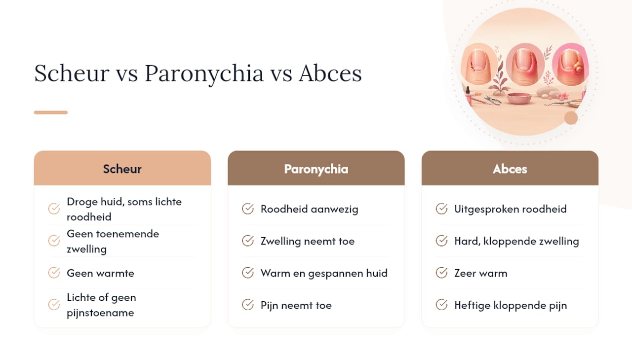 Verschil tussen een scheur en paronychia