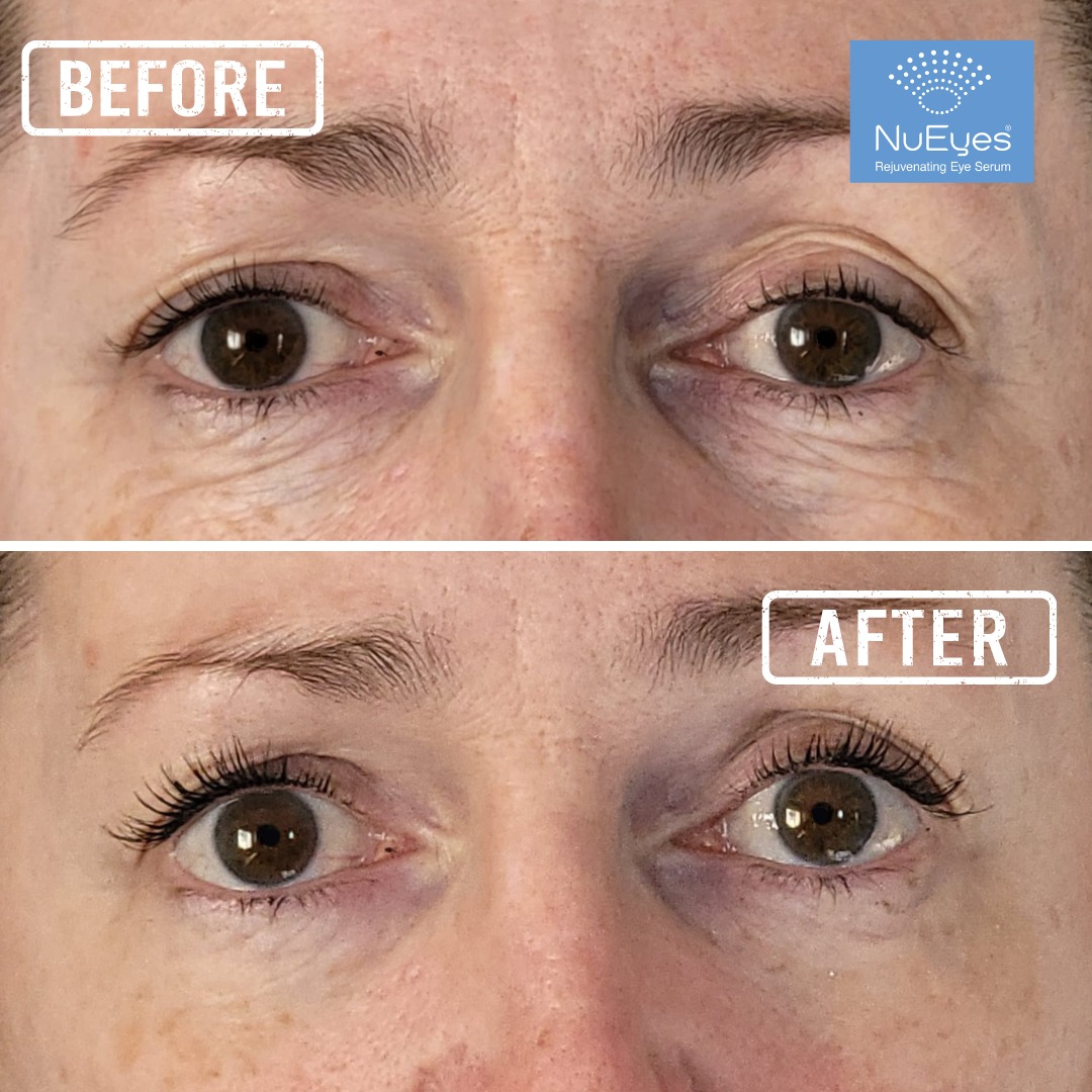 NuEyes Instant Eye Lift Serum.