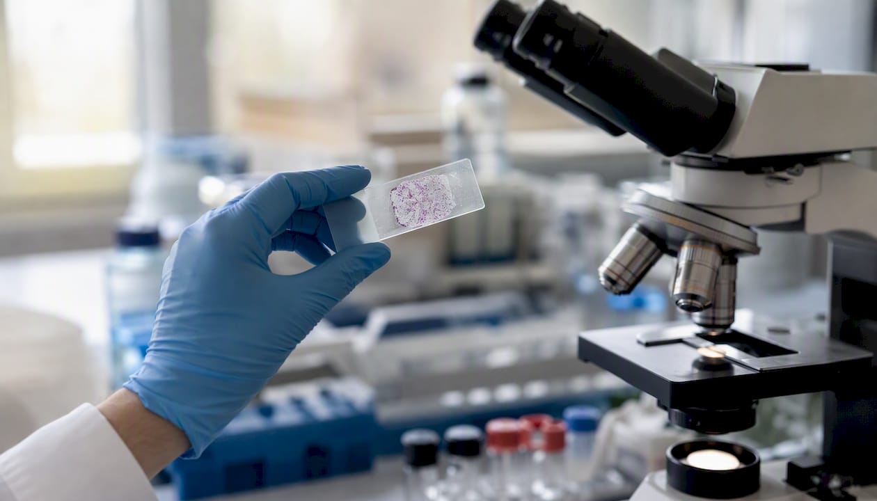 Lab slide showing collagen degrading enzymes