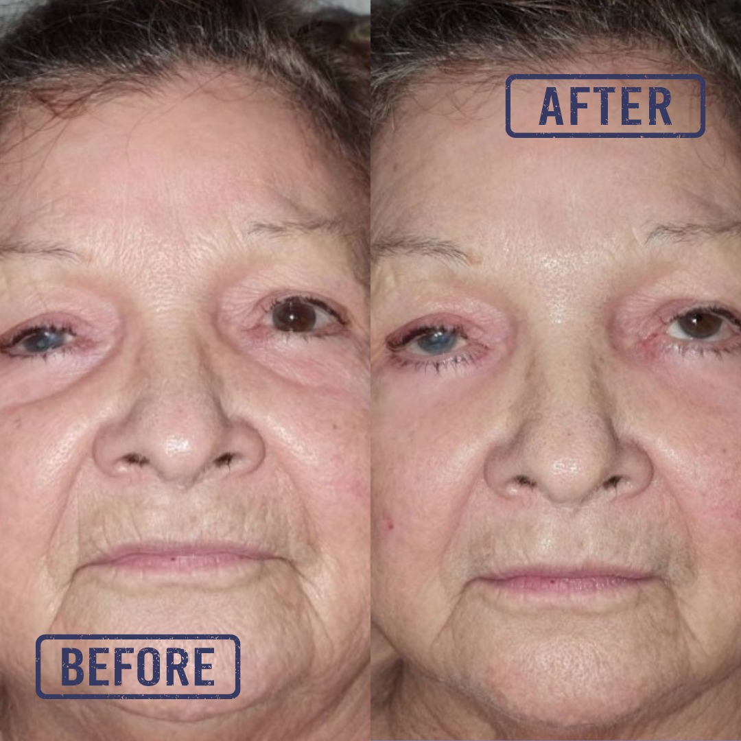 NuRejuv Collagen Instant Lift Face Cream