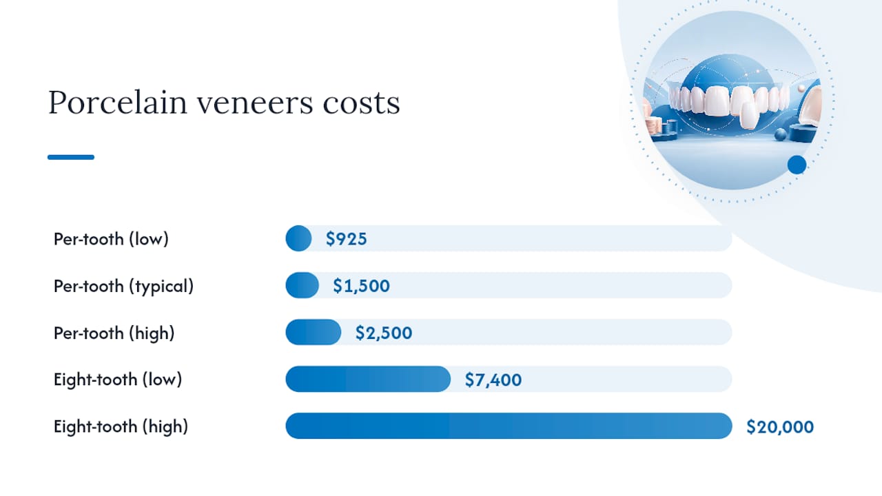 Diagram summarizing porcelain veneers cost factors and price ranges