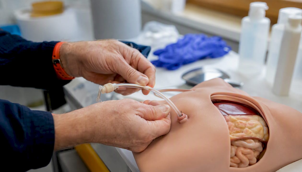Medical hands demonstrating gastrostomy tube model