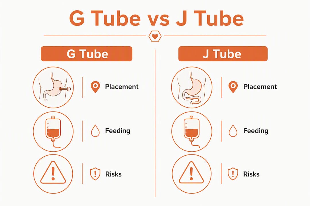 Infographic comparing G tube and J tube differences