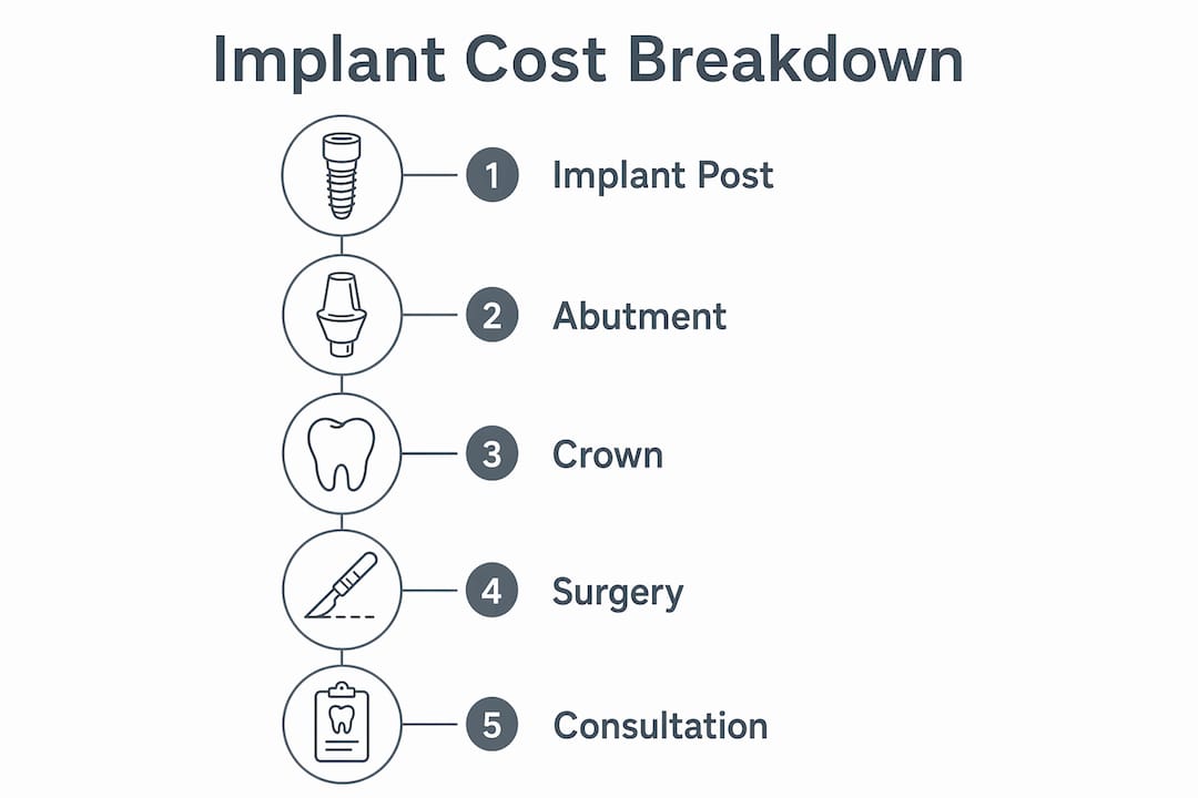 Infographic showing dental implant cost components in flow chart
