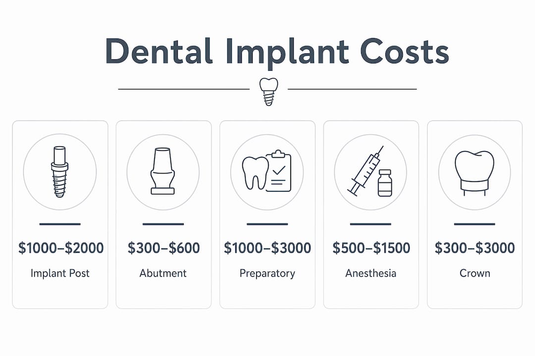 Infographic showing key dental implant cost components