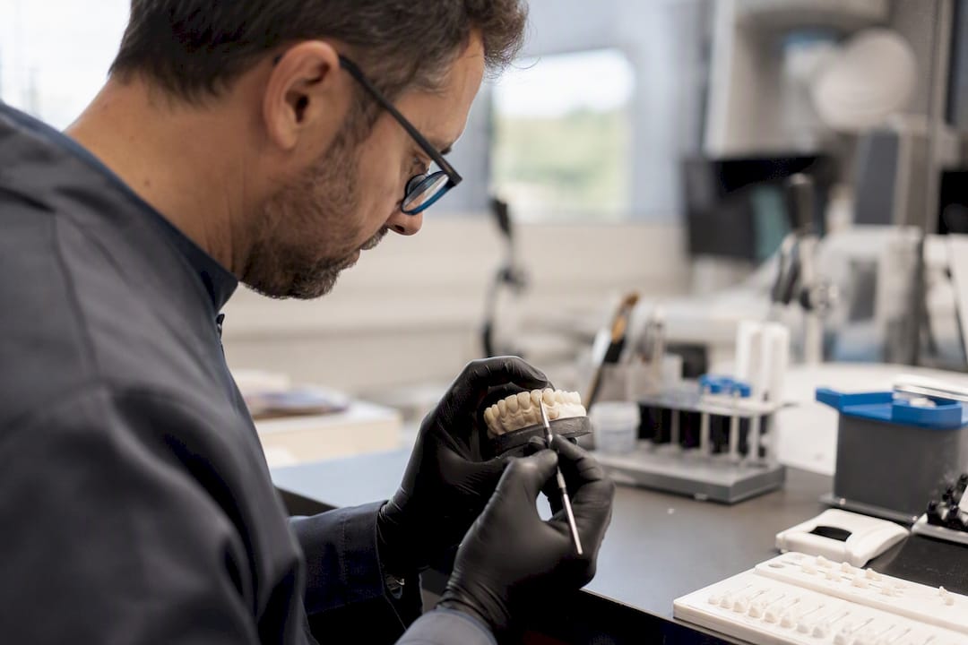 Dental technician shaping resin veneer on model tooth