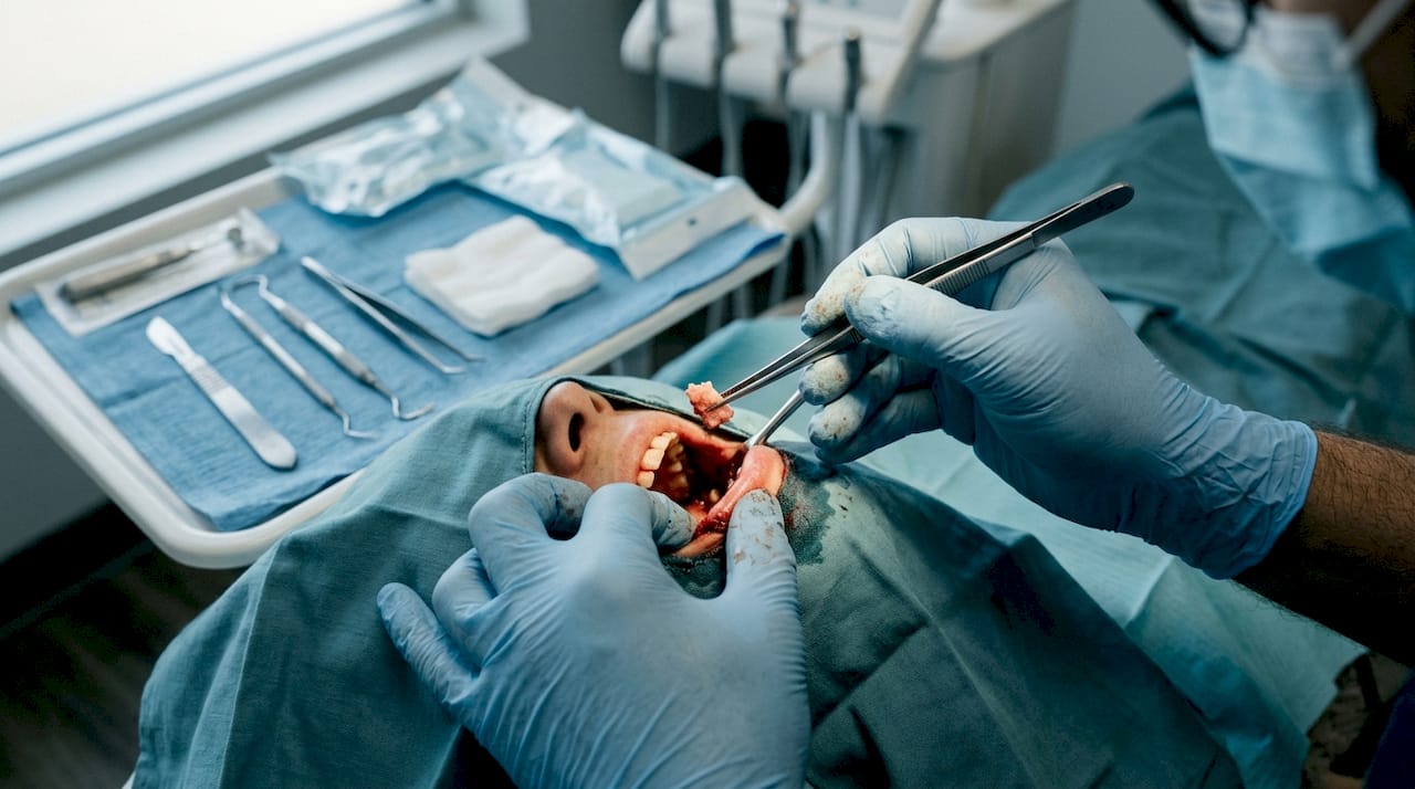 Surgeon harvesting autograft bone piece
