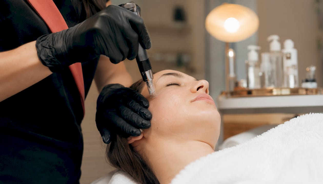 Technician performing RF microneedling treatment